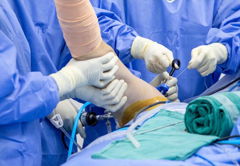 Surgical Procedure