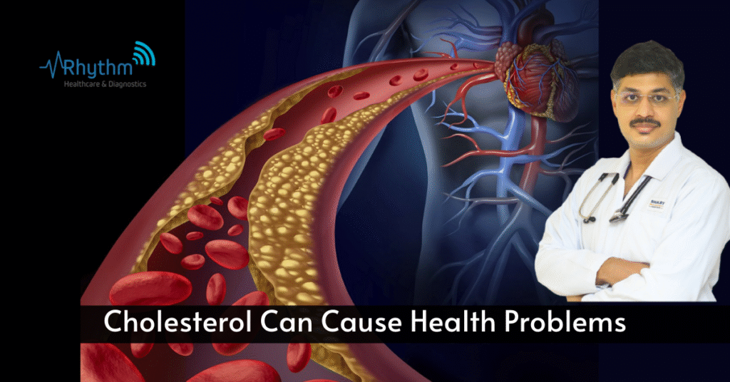 Cholesterol Can Trigger Health Problems - dr siddhant jain