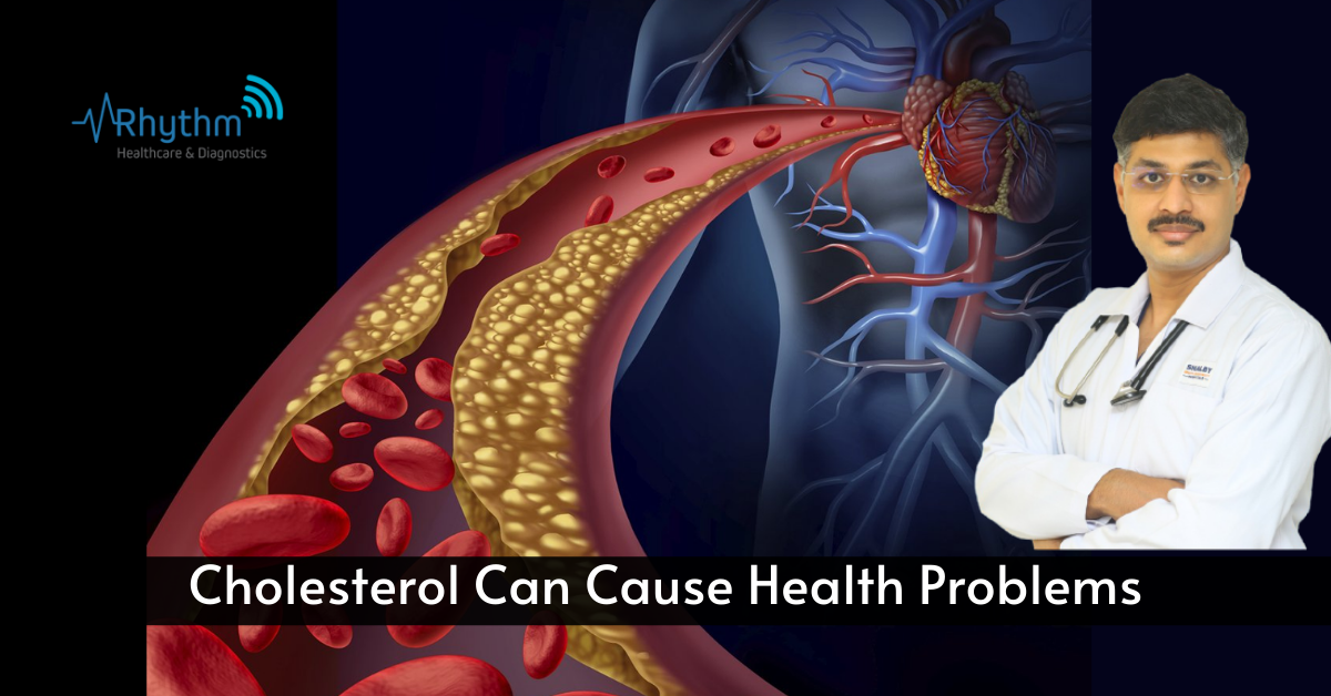 Cholesterol Can Trigger Health Problems - dr siddhant jain